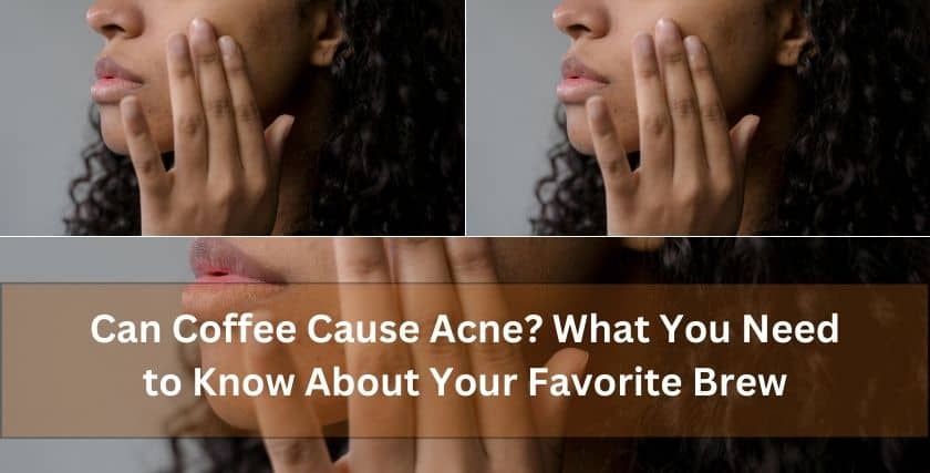 Can Coffee Cause Acne_I